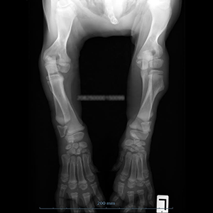 Newfoundland Puppy Affected with FLA/CRHL